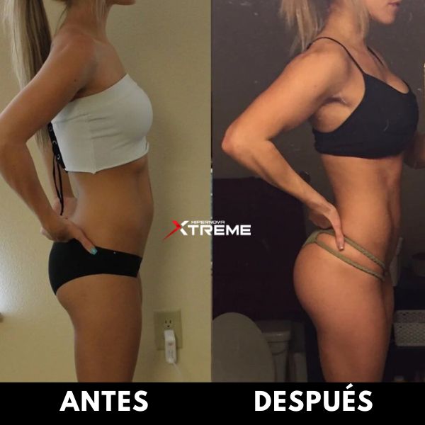 ANTES (4)