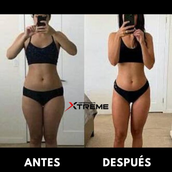 ANTES (5)